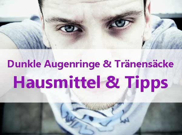 dunkle Augenringe was tun gegen Tränensäcke und Ringe unter den Augen ?